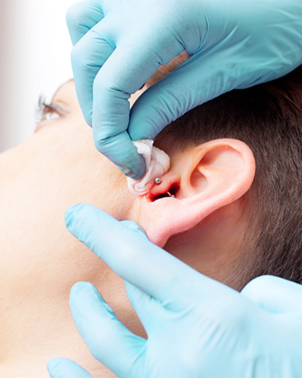 sau khi bấm khuyên tai cần làm gì